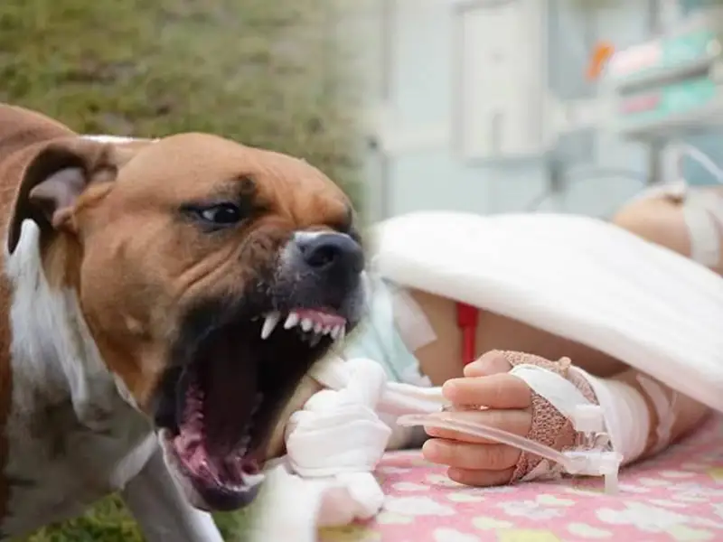 Атырауда ит талаған екі жасар бала ем алып жатыр