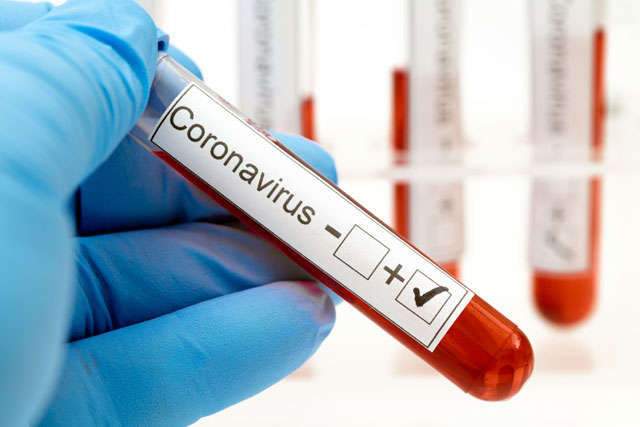 Атырауда тәулік ішінде 18 адамнан вирус анықталды