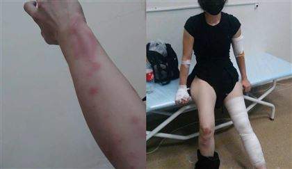 Алматыда полицейлер әйел адамның аяқ-қолын сындырып тастаған