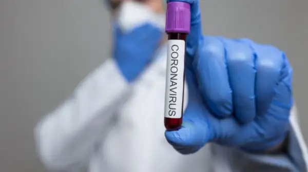 Елімізде эпидемиологиялық жағдай нашарлады