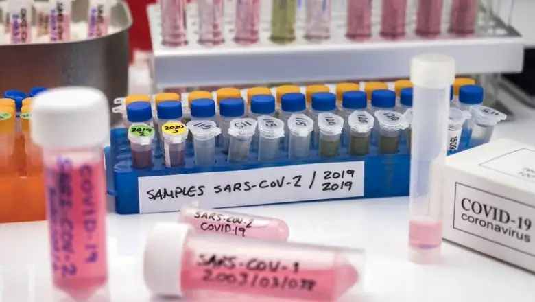 Соңғы тәулікте коронавирус жұқтырғандар саны 250-ден асты