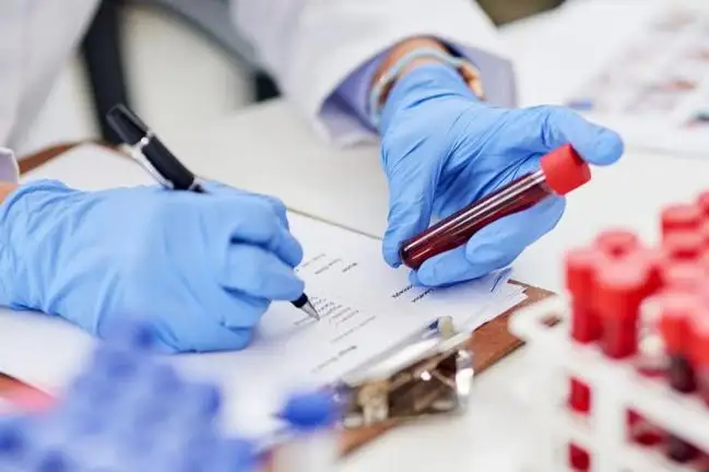 Қазақстанда өткен тәулікте 878 адамнан коронавирус табылды