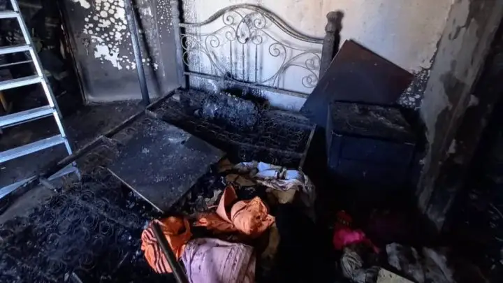 Павлодарда басына телефонын жастап жатқан қыздың басын күйік шалды