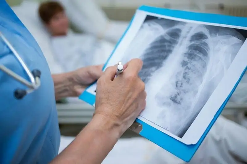 Пневмониядан 5 адам қаза тапты