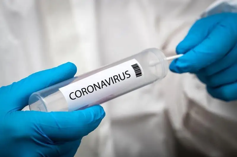 Тағы 148 адамнан коронавирус анықталды