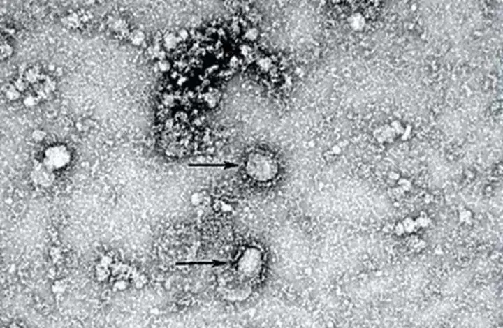 Жедел тест коронавирусты 8-15 минут ішінде анықтайды