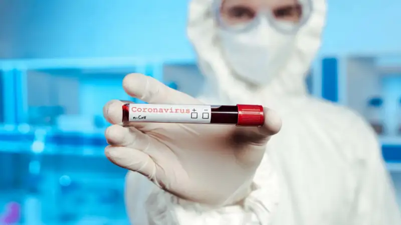 Шымкентте 181 адам коронавирустан жазылды 