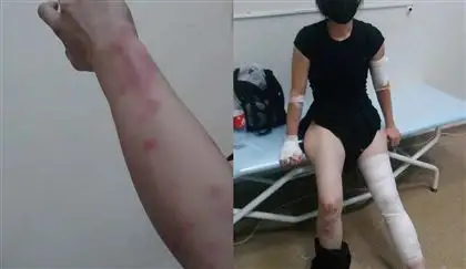 Алматыда полицейлер әйел адамның аяқ-қолын сындырып тастаған
