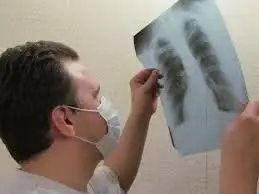 Дүниежүзілік денсаулық сақтау ұйымы Қытайда балалар арасында жаңа індет тарады дегенді жоққа шығарды