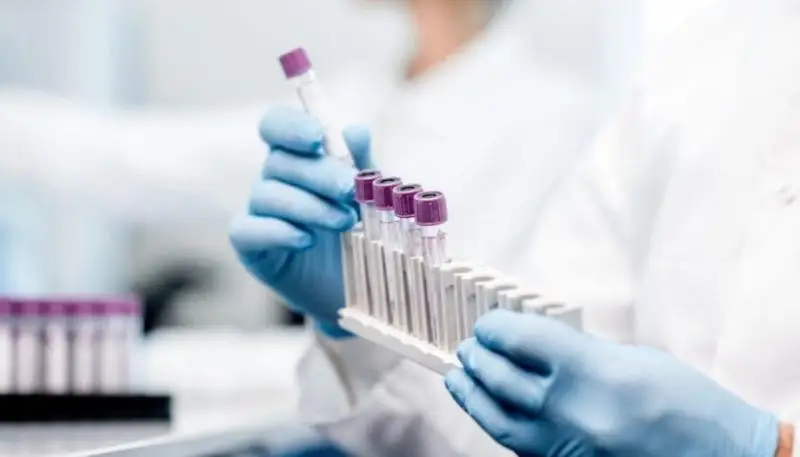 Өткен тәулікте коронавирус жұқтырған адамдар саны өсті