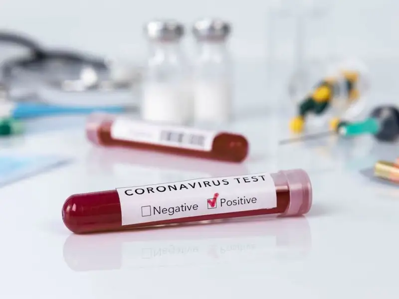Әлемде коронавирус жұқтырғандар саны 25 миллионнан асты