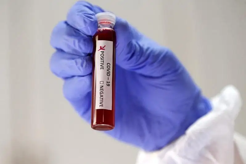 Қарағанды облысында тағы 56 адам коронавирус жұқтырған