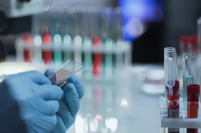 Коронавирус жұқтырғандармен қанша адам байланыста болғаны белгілі болды