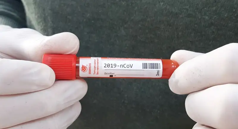 Қазақстанда коронавирус жұқтырғандар1661-ге жетті