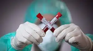 Коронавирус бойынша бір тәуліктегі мәліметтер жарияланды