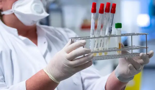 Өткен тәулікте 1310 адамнан коронавирус анықталды