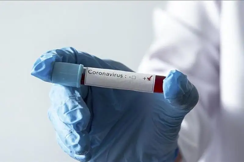 Тағы 747 адамнан вирус анықталды