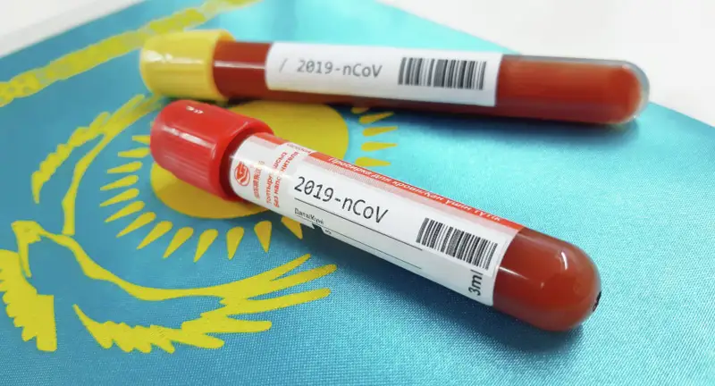 55 адам коронавирустан жазылып шықты  