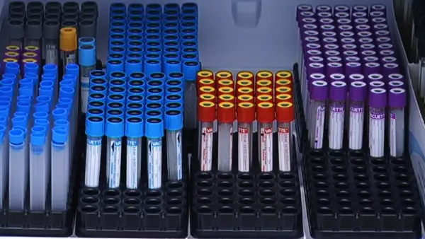 Елімізде өткен тәулікте 100 адамнан коронавирус анықталды 