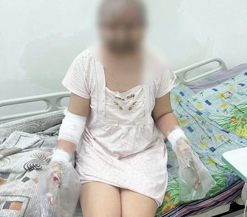 Алматыда ер адам бұрынғы әйеліне бензин шашып, өртеп жіберді