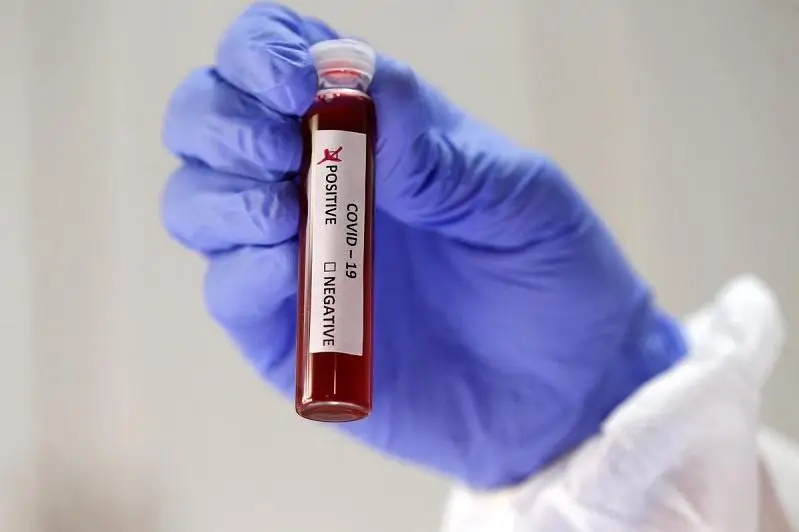 494 адам коронавирус жұқтырды