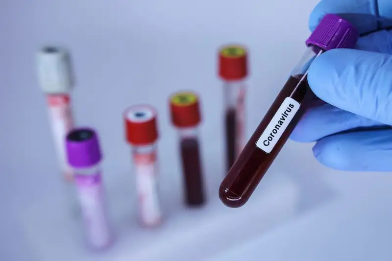 Алматыда студенттер жатақханасынан коронавирус анықталды