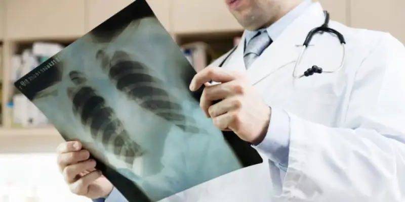 Пневмонияға шалдыққан сырқаттар саны 27 мыңнан асты 