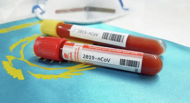 Cоңғы тіркелген 10 науқастың бәрі де Ресейден келген