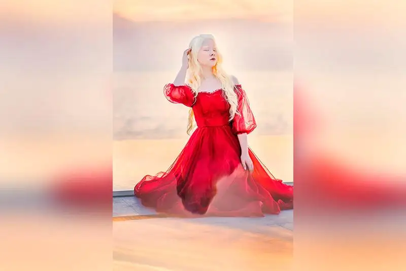 Ақтаулық альбинос қыз америкалық өнімнің жарнамалық ролигіне түсті   