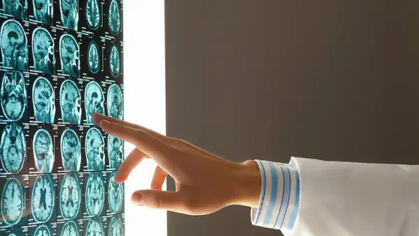 Адамның басынан жаңа орган табылды