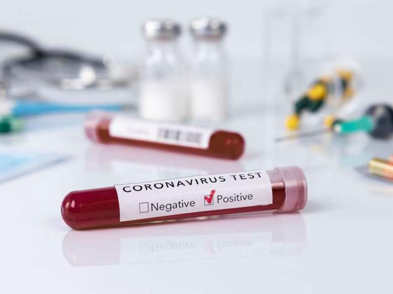 Әлемде коронавирус жұқтырғандар саны 25 миллионнан асты