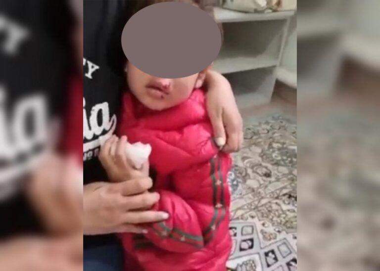 Атырауда қаңғыбас ит талаған 5 жасар қыз ауруханаға жеткізілді 