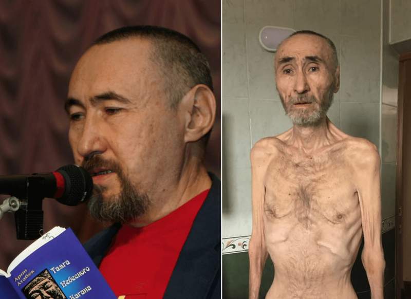 Арон Атабек реанимацияға түсті