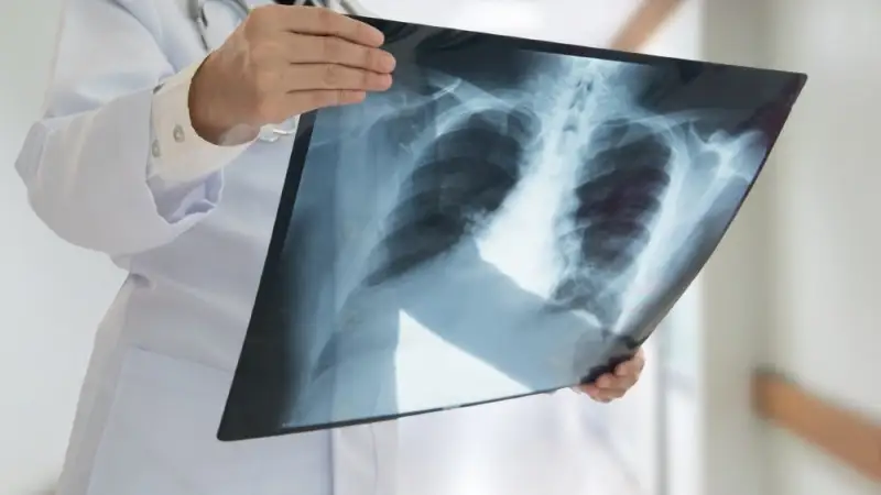 Коронавирустың өкпеге әсері қандай?