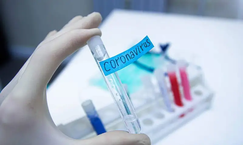 Коронавирусқа тест жүргізу күніне 30 мыңға дейін өсті