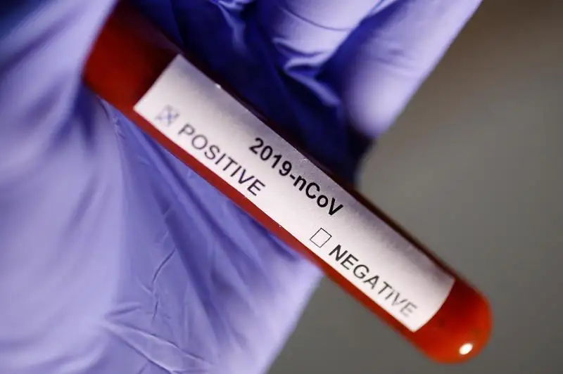 Инфекция жұқтырғандар өз бетінше дәрігерга барған