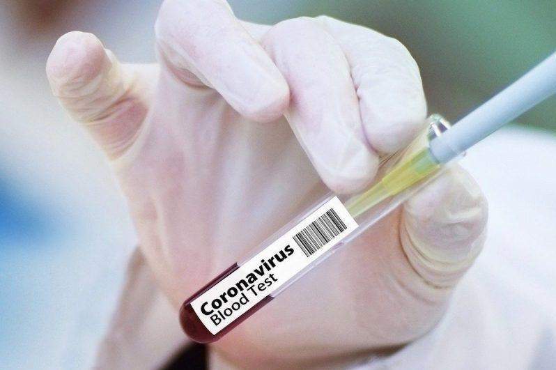Әлемде коронавирусқа шалдыққандар саны 21,6 миллионға жуықтады 