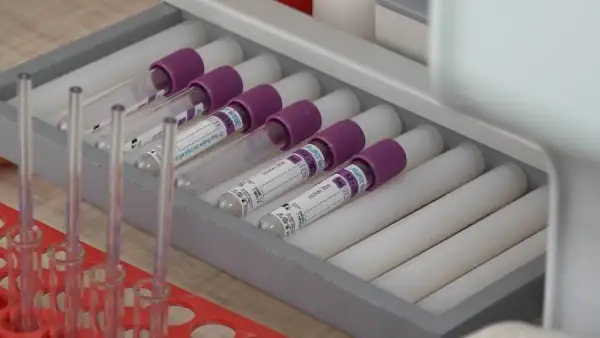 А.Цой коронавирустың жаңа штамдары жоқ өңірді атады 