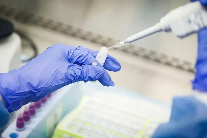 Вирусқа қанша адам тест тапсырды?