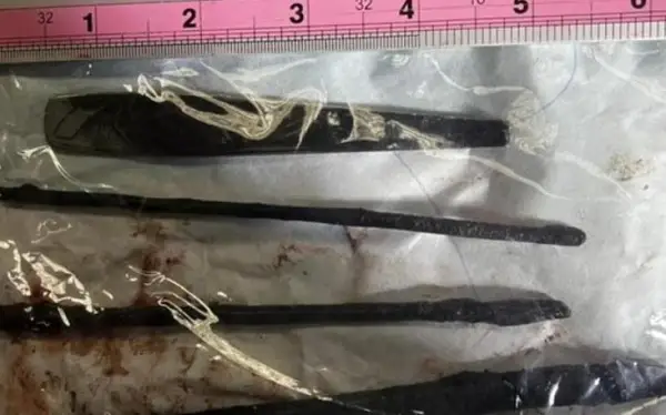 Науқастың асқазанынан ұзындығы 15-18 см үш темір алып шықты