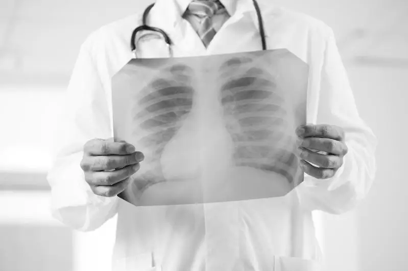 Коронавирус пен пневмониядан 17 адам көз жұмды