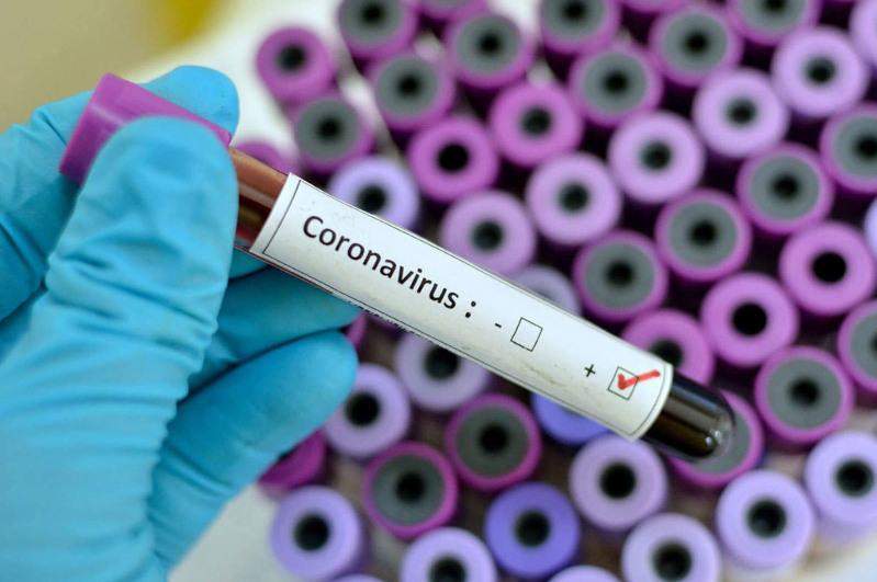 Өткен тәулікте 142 адам коронавирус инфекциясын жұқтырған 
