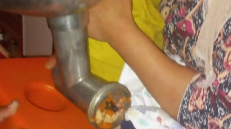 Шымкентте екі жасар баланың қолы еттартқышта қалып қойды