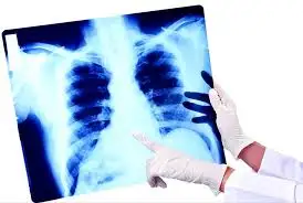 «Белгісіз пневмония» мен Covid-19 статистикасы НЕГЕ бірге есептелмейді?