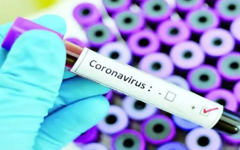 Коронавирус кезінде ішуге қауіпті дәрілер қандай?