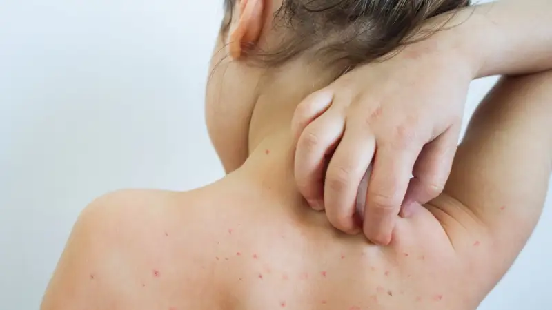 Қызылша ауруы