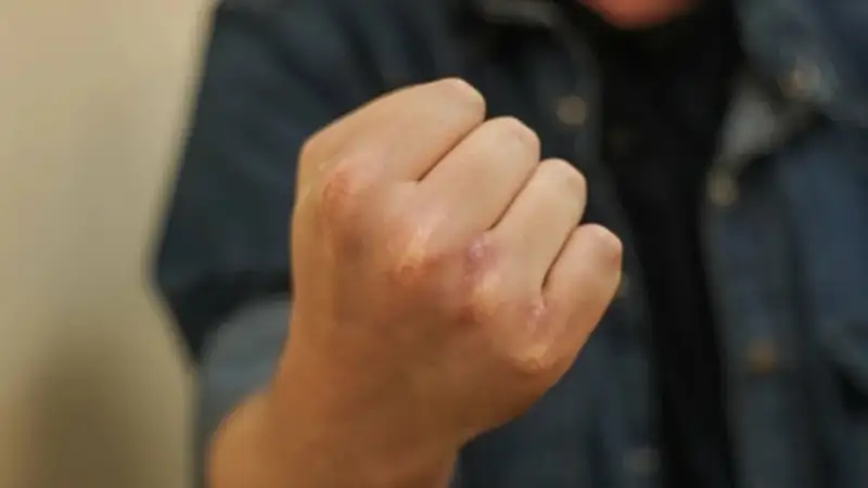 Әлімжеттік