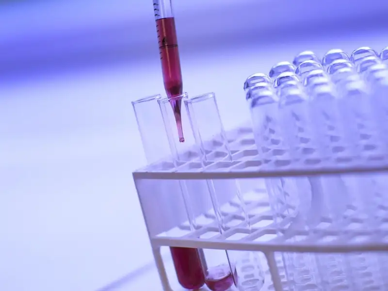 Скрининг, денсаулық