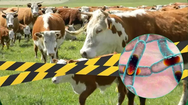 Сібір жарасы