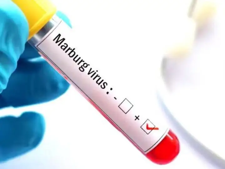 Марбург вирус